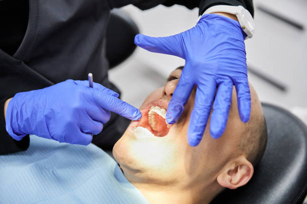 Best Emergency Wisdom Teeth Removal in Coord, NC