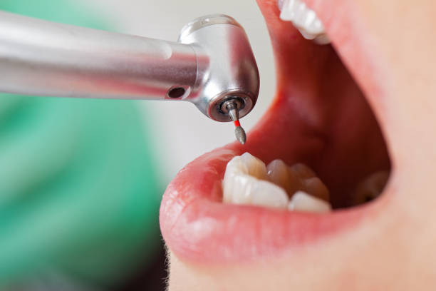 Best Same-Day Emergency Dental Services in Coord, NC